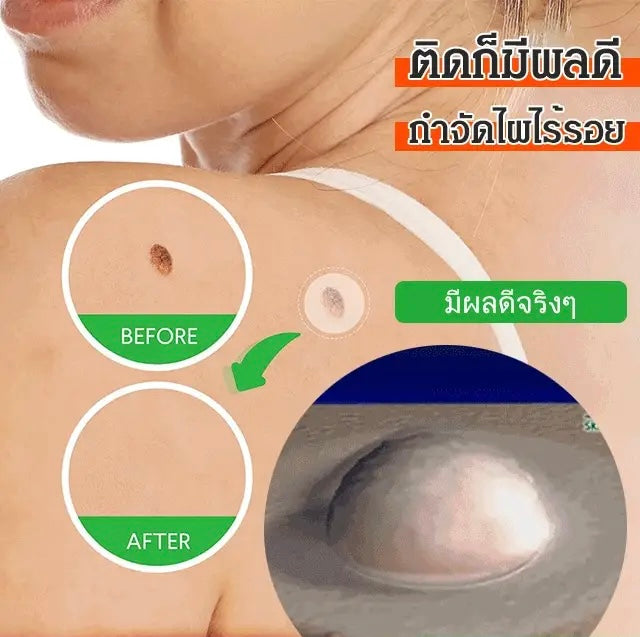 لاصقات تجميل صغيرة للبشرة | لاصقات إزالة الشامات المخفية
