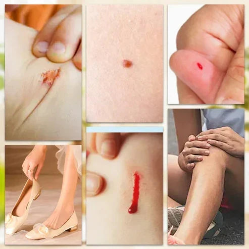 Waterproof Breathable Bandage | ضمادات مقاومة للماء وقابلة للتنفس