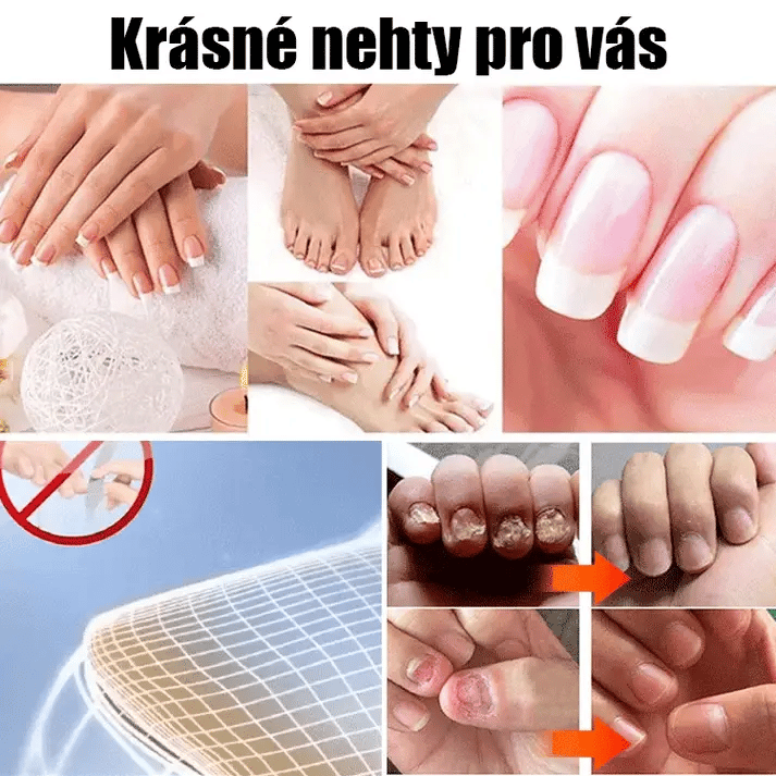 كريم معالجة الأظافر