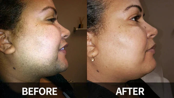 كريم لطيف لإزالة شعر الوجه | Gentle and Painless Facial Hair Removal Cream