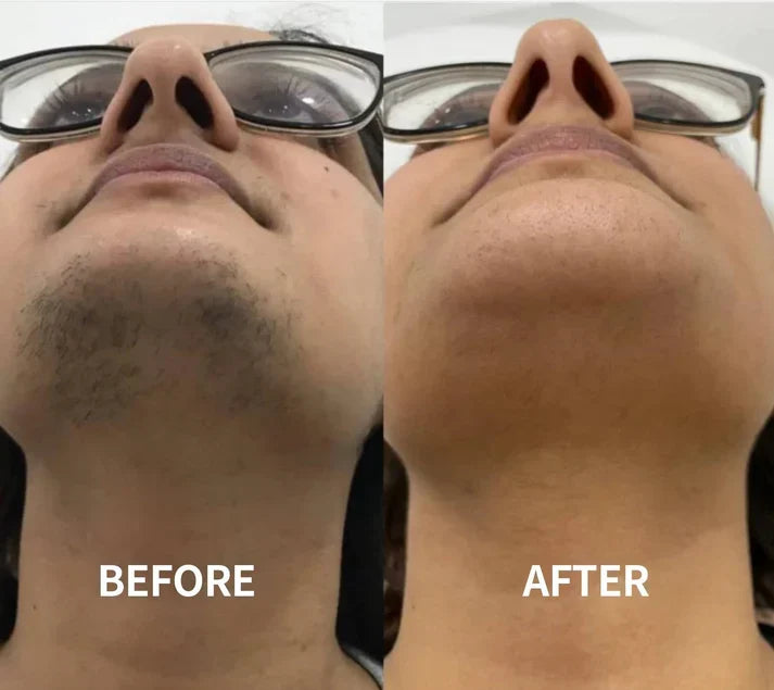 كريم لطيف لإزالة شعر الوجه | Gentle and Painless Facial Hair Removal Cream
