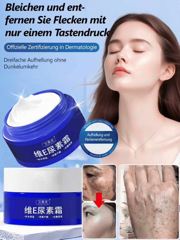 كريم يوريا لتفتيح البقع | Stain Lightening Urea Cream